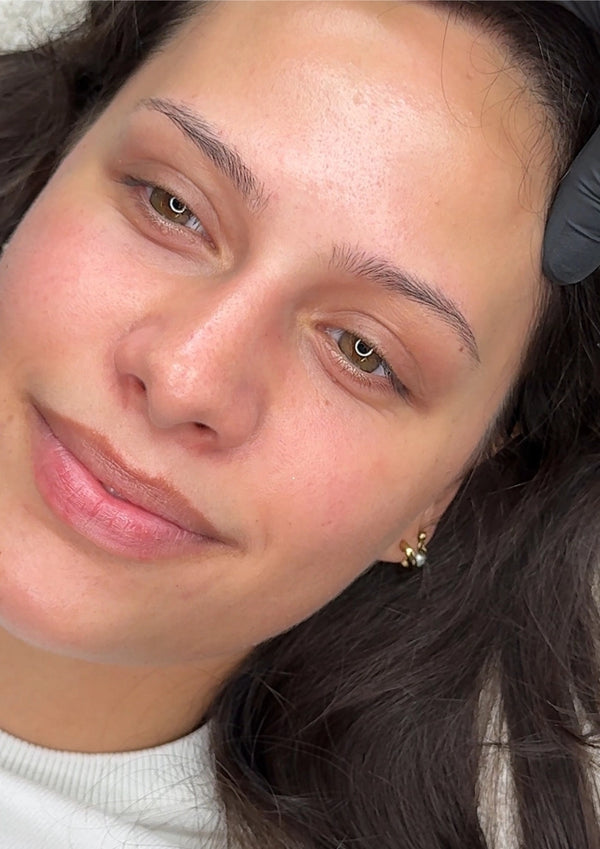 Before — Brow Extension result